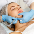 microdermabrasion